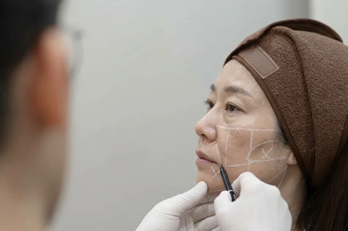 얼굴 균형을 보며 시술 위치를 표시하는 장면